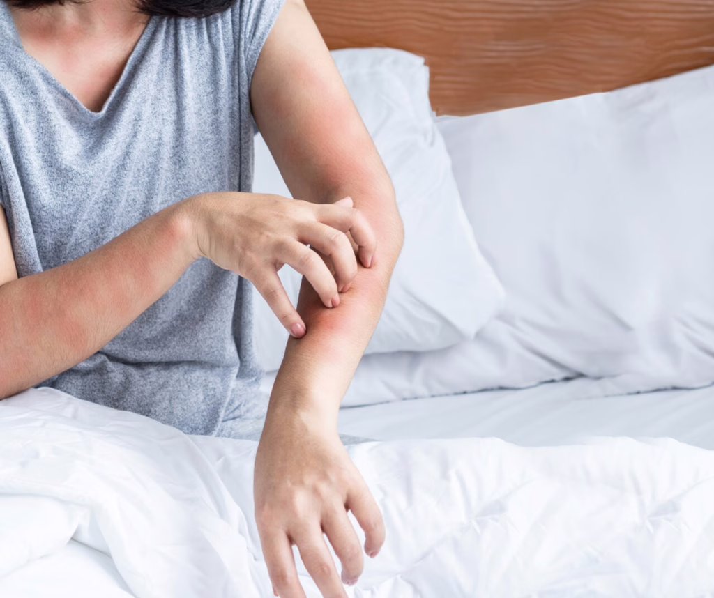 Życie z alergią: jak nie dać się zwariować i żyć pełnią