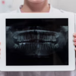 Odrastanie zębów — czy to możliwe?