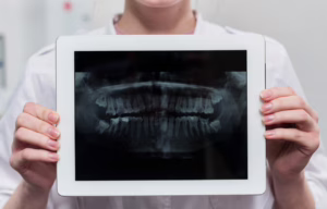 Odrastanie zębów - czy to możliwe?