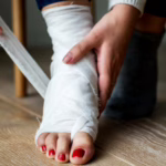 Rehabilitacja po operacji haluksów – jak bezpiecznie wrócić do aktywności?